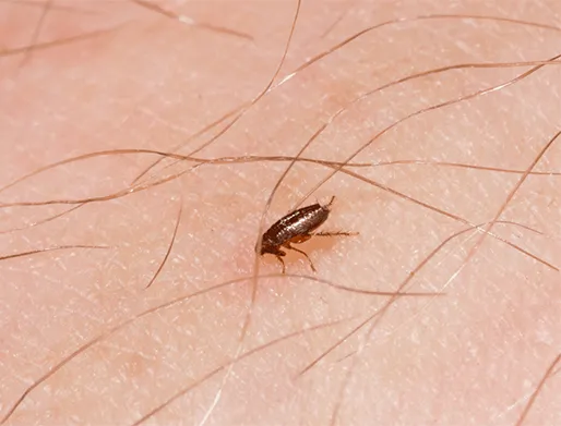 Dedetização de Pulgas em Itaim Bibi